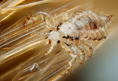 Een mannelijke hoofdluis (Pediculus humanus capitis), macro-opname van een mannelijk exemplaar. Auteur: Giles San Martin. Licentie: Public Domain.